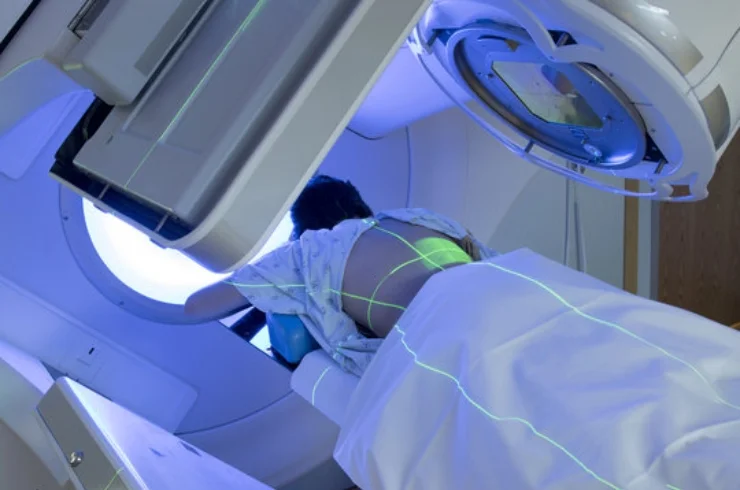 Advanced Radiation Therapy Techniques